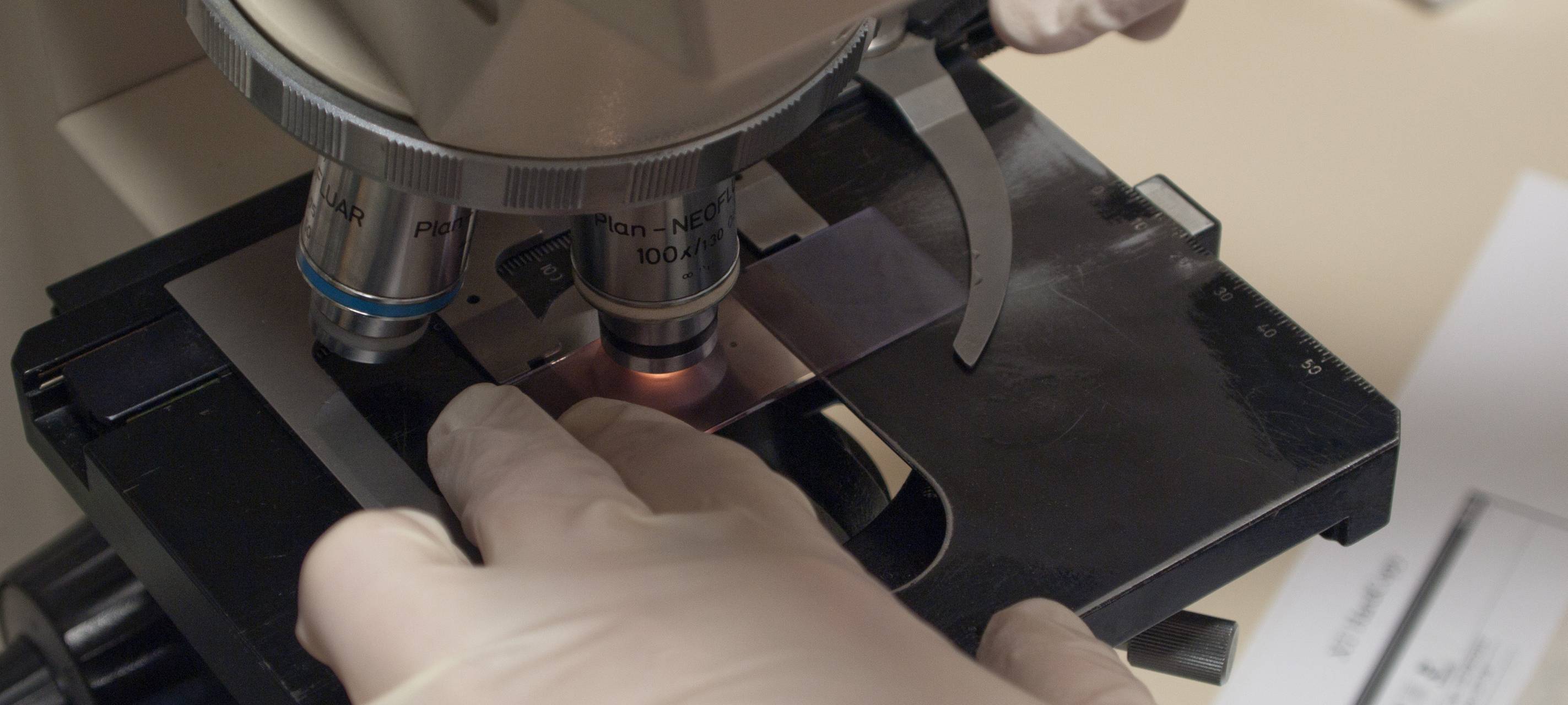 Uni Witten/Herdecke forscht an Krebstherapien