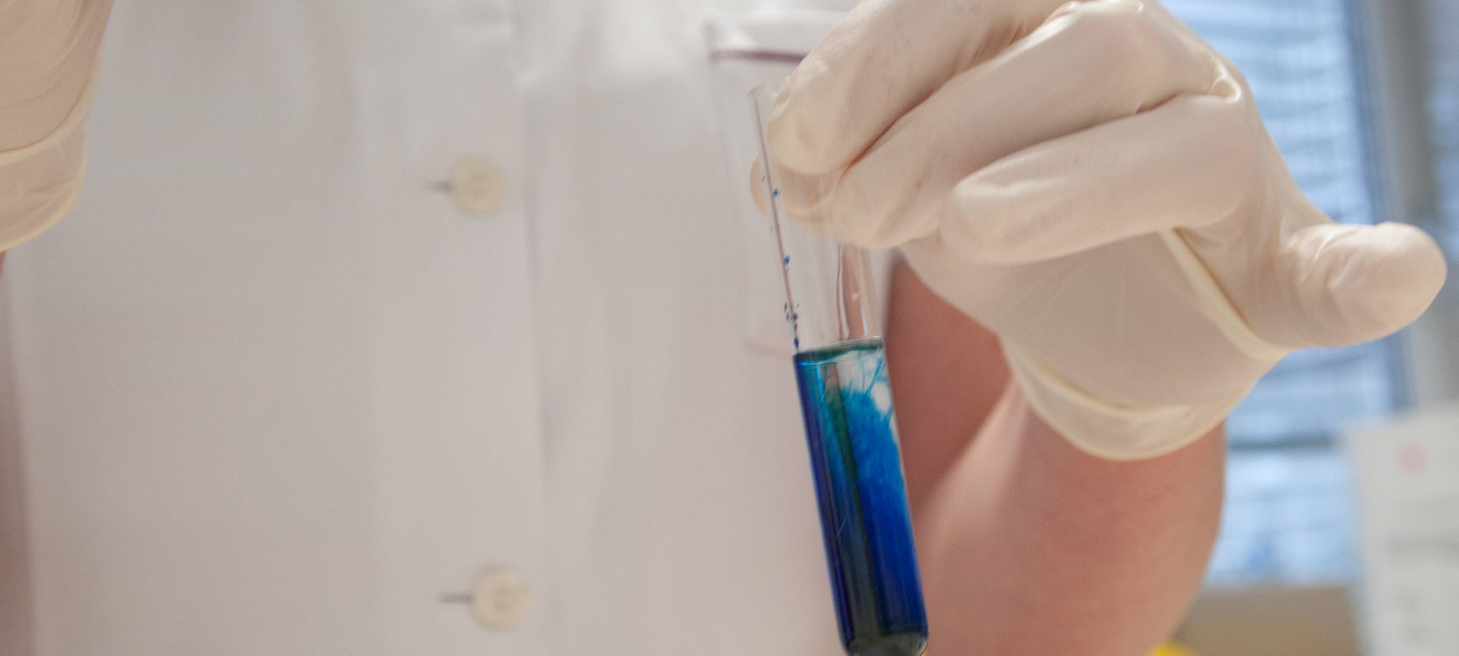 Kreis rät bei Coronavirus zur Besonnenheit